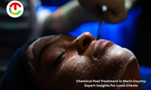 Chemical Peel Treatment in Marin County: Expert Insights For Local Clients