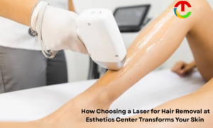 How Choosing a Laser for Hair Removal at Esthetics Center Transforms Your Skin