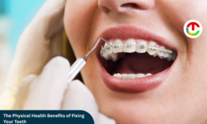 The Physical Health Benefits of Fixing Your Teeth